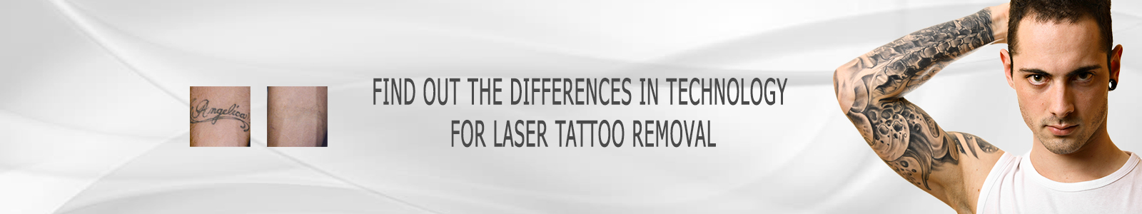 Tattoo Removal Technology
