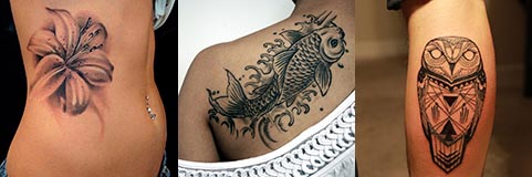 Large_Tattoo_Removal_Prices (1)